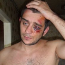 У Донецьку міліціонери жорстоко побили журналіста та його друзів: били ногами і кийками, закувавши в наручники