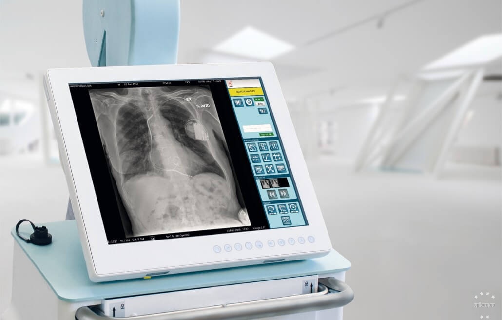 Уряд виділив кошти на закупівлю 84 рентген-апаратів для лікарень, 24 з них отримає Чернігівщина