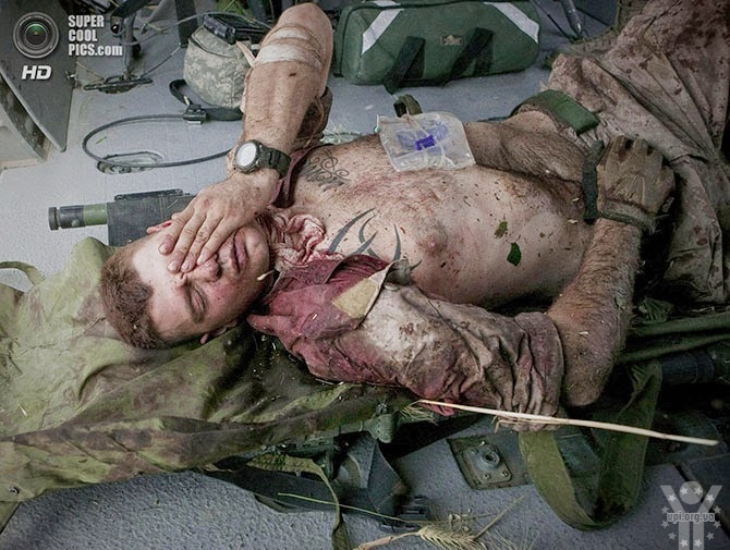 Медики непритомніли, коли бачили поранених під Зеленопіллям українських бійців. Відео