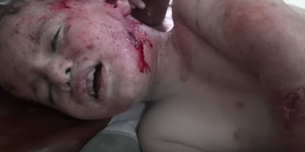 Від російських авіаударів у Сирії загинуло понад 60 мирних мешканців: жахливе відео