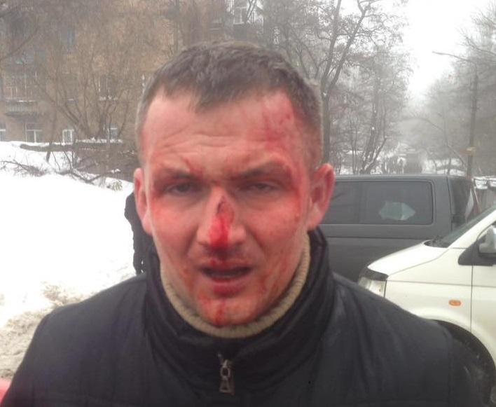 У Києві жорстоко побили нардепа свободівця Юрія Левченка