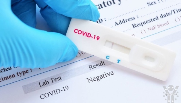 Мільйон експрес-тестів для визначення COVID-19 доставлені в регіони